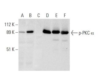 p-PKC alpha Antibody (A-11) - Western Blotting - Image 297896 