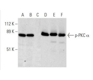 p-PKC alpha Antibody (pT638.35) - Western Blotting - Image 383034 