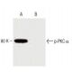 p-PKC alpha Antibody (pT638.35) - Western Blotting - Image 383021