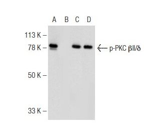 p-PKC beta 2/delta Antibody (E-7) - Western Blotting - Image 141605 