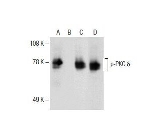 p-PKC delta Antibody (H-9) - Western Blotting - Image 153648 