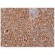 p-PKC theta Antibody (A-11) - Immunohistochemistry - Image 285731 