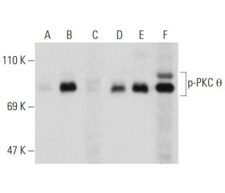p-PKC theta Antibody (pT538.19) - Western Blotting - Image 135213 