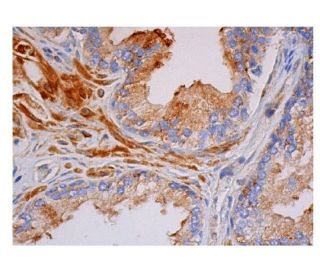 p-PKC zeta Antibody (H-2) - Immunohistochemistry - Image 350577 