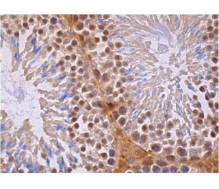 p-PRC1 Antibody (C-2) - Immunohistochemistry - Image 384120 