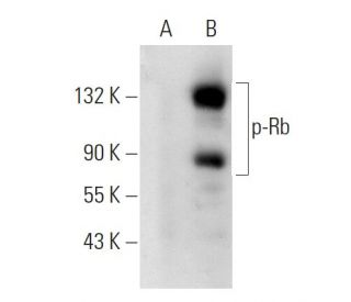 p-Rb Antibody (7F10) - Western Blotting - Image 22014 