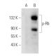 p-Rb Antibody (7F10) - Western Blotting - Image 22014 