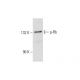 p-Rb Antibody (7F10) - Western Blotting - Image 128892