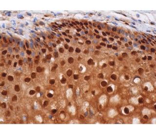 p-Rb Antibody (A-5) - Immunohistochemistry - Image 286536 