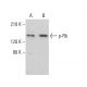p-Rb Antibody (B-4) - Western Blotting - Image 375363 
