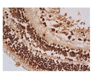 p-Rb Antibody (B-7) - Immunohistochemistry - Image 352268 
