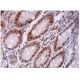 p-Rb Antibody (B-8) - Immunohistochemistry - Image 293703 