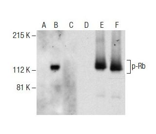 p-Rb Antibody (B-8) - Western Blotting - Image 285168 