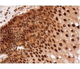 p-Rb Antibody (C-3) - Immunohistochemistry - Image 286533 