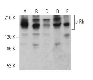 p-Rb Antibody (E-10) - Western Blotting - Image 370876 