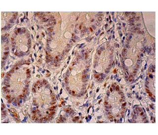 p-Rb Antibody (F-2) - Immunohistochemistry - Image 298941 