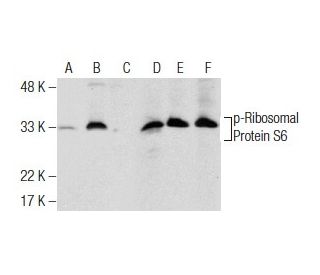 p-Ribosomal Protein S6 Antibody (24.Ser 240) - Western Blotting - Image 159484 