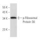 p-Ribosomal Protein S6 Antibody (24.Ser 240) - Western Blotting - Image 357441