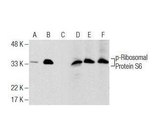 p-Ribosomal Protein S6 Antibody (50.Ser 235/236) - Western Blotting - Image 159480 