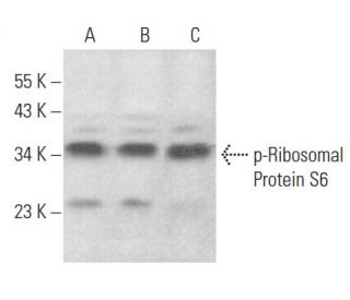 p-Ribosomal Protein S6 Antibody (B-6) - Western Blotting - Image 354437 