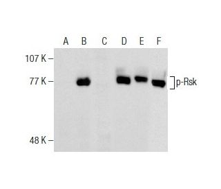 p-Rsk Antibody (C-5) - Western Blotting - Image 159772 
