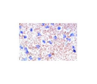 P-Selectin/CD62P/SELP Antibody (P8G6) - Immunohistochemistry - Image 5267 