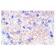P-Selectin/CD62P/SELP Antibody (P8G6) - Immunohistochemistry - Image 5267 