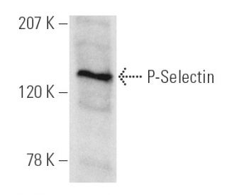 P-Selectin/CD62P/SELP Antibody (CTB201) - Western Blotting - Image 130797Each CRISPR/Cas9 Knockout (KO) Plasmid product consists of a pool of 3 plasmids designed to ensure identification and cleavage of a specific gene for maximum knockout efficiency. Each plasmid encodes a unique 20 nt sequence derived from the GeCKO (v2) library.
