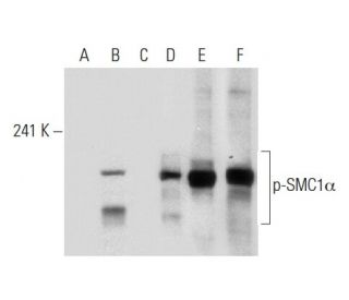 p-SMC1&alpha; Antibody (43.Ser 966) - Western Blotting - Image 133085 
