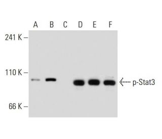 p-Stat3 Antibody (pS727.49) - Western Blotting - Image 134834 