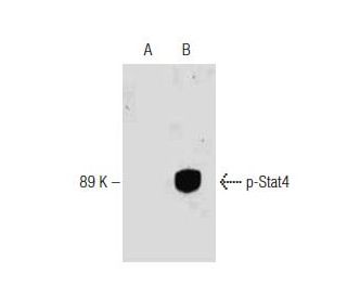 p-Stat4 Antibody (pY693.38) - Western Blotting - Image 127557