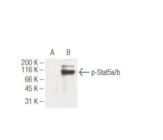 p-Stat5a/b Antibody (5G4) - Western Blotting - Image 62941