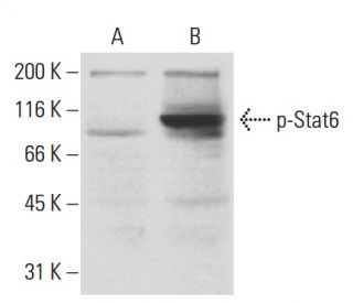 p-Stat6 Antibody (16E12) - Western Blotting - Image 62942