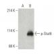 p-Stat6 Antibody (pY641.18) - Western Blotting - Image 396370