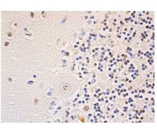 p-Tau Antibody (6A192) - Immunohistochemistry - Image 352866 