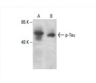 p-Tau Antibody (PHF-13) - Western Blotting - Image 393058
