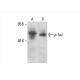 p-Tau Antibody (PHF-13) - Western Blotting - Image 393058