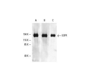 Phosphotyrosine Antibody (PY20) - Western Blotting - Image 5571 