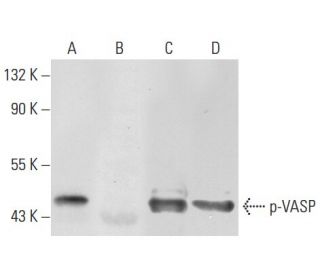 p-VASP Antibody (16C2) - Western Blotting - Image 72649 