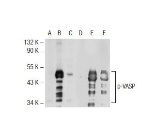 p-VASP Antibody (5C6) - Western Blotting - Image 72650 