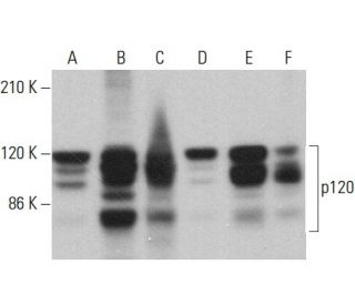 p120 Antibody (15D2) - Western Blotting - Image 379522 