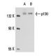 p130 Antibody (DCS-211) - Western Blotting - Image 15464