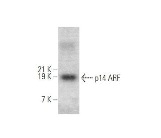 p14ARF Antibody (ARF 4C6/4) - Western Blotting - Image 349907 