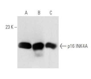 CDKN2A/p16 Antibody (JC8) - Western Blotting - Image 15234
