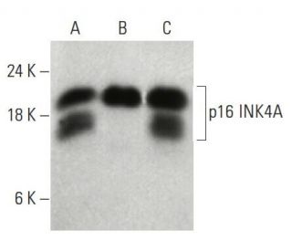 CDKN2A/p16 Antibody (JC8) - Western Blotting - Image 397540