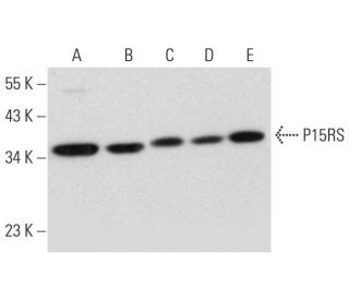 P15RS Antibody (C-6) - Western Blotting - Image 326558 