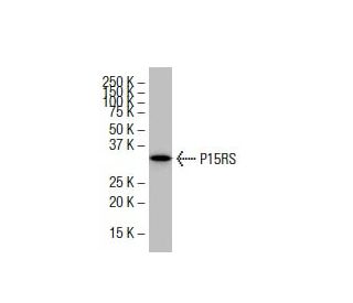 P15RS Antibody (FF-8) - Western Blotting - Image 33495 