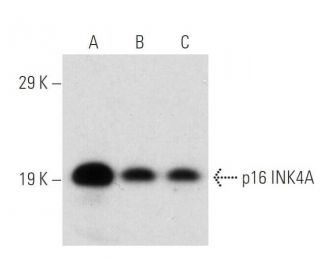 CDKN2A/p16 Antibody (50.1) - Western Blotting - Image 145086 