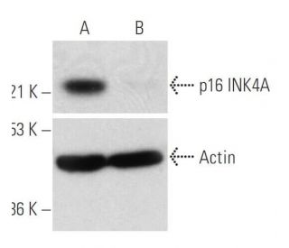 p16 INK4A siRNA (h): sc-36143. Western blot analysis of p16 INK4A expression in non-transfected control (A) and p16 INK4A 