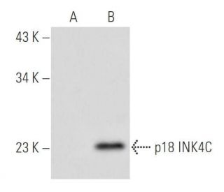 CDKN2C/p18 INK4c Antibody (18P118) - Western Blotting - Image 66128